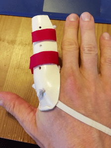 Finger splint