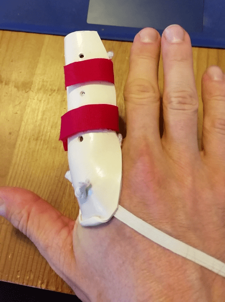 Finger splint